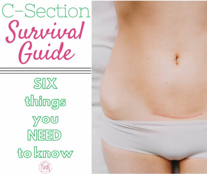 c-section survival guide - 6 things you need to know